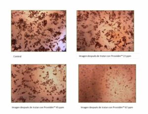 crema anticelulitica antes y despues provislim